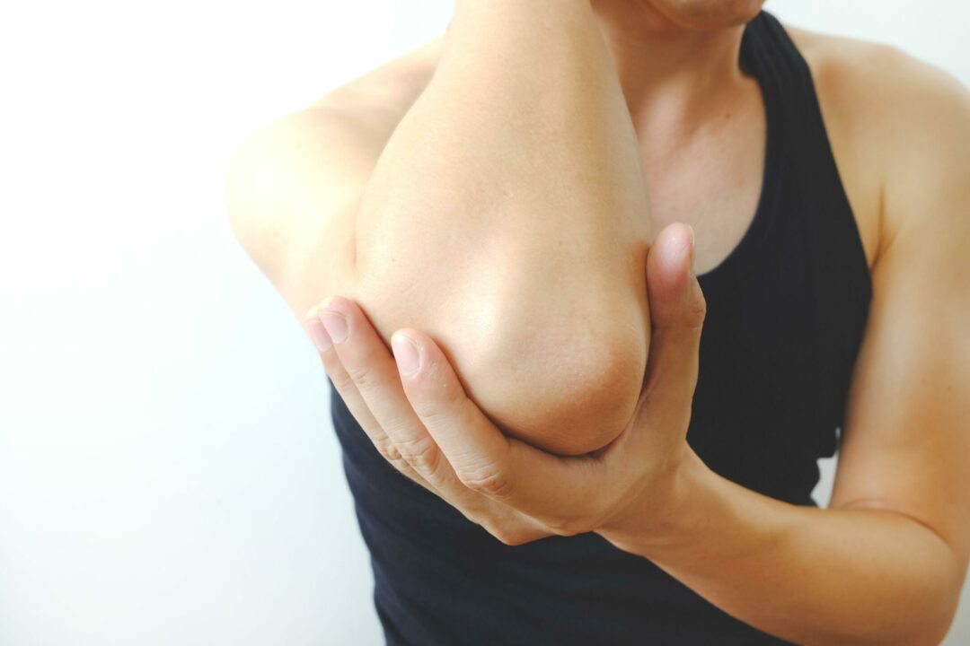 Bursitis