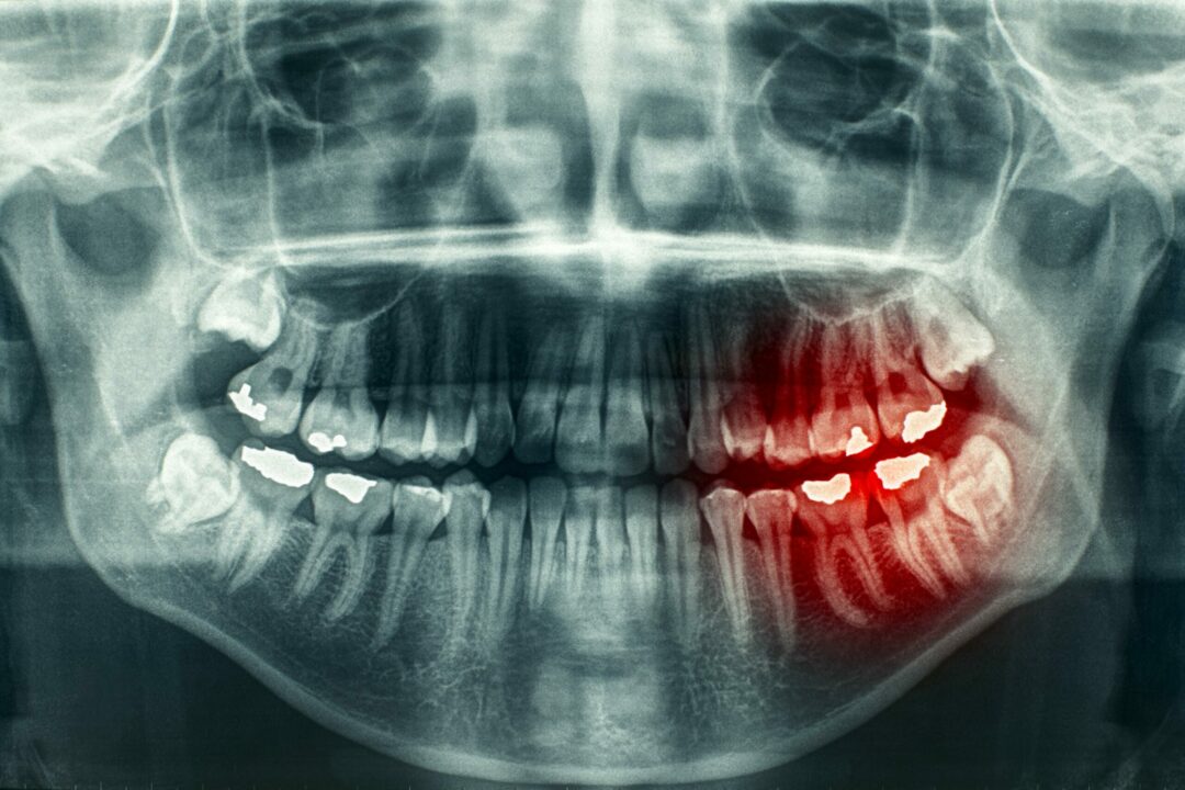 Trastornos dentales